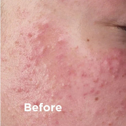 Black Clay SOS Natural Dead Sea Mud Mask 75ml - Sea Magik - Skin Care Masks & Peels - Sea Magik