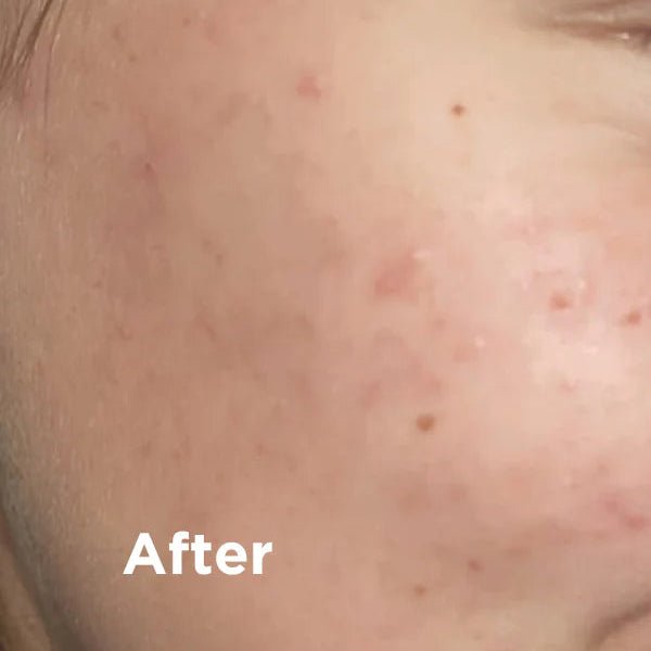 Black Clay SOS Natural Dead Sea Mud Mask 75ml - Sea Magik - Skin Care Masks & Peels - Sea Magik