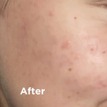 Black Clay SOS Natural Dead Sea Mud Mask 75ml - Sea Magik - Skin Care Masks & Peels - Sea Magik